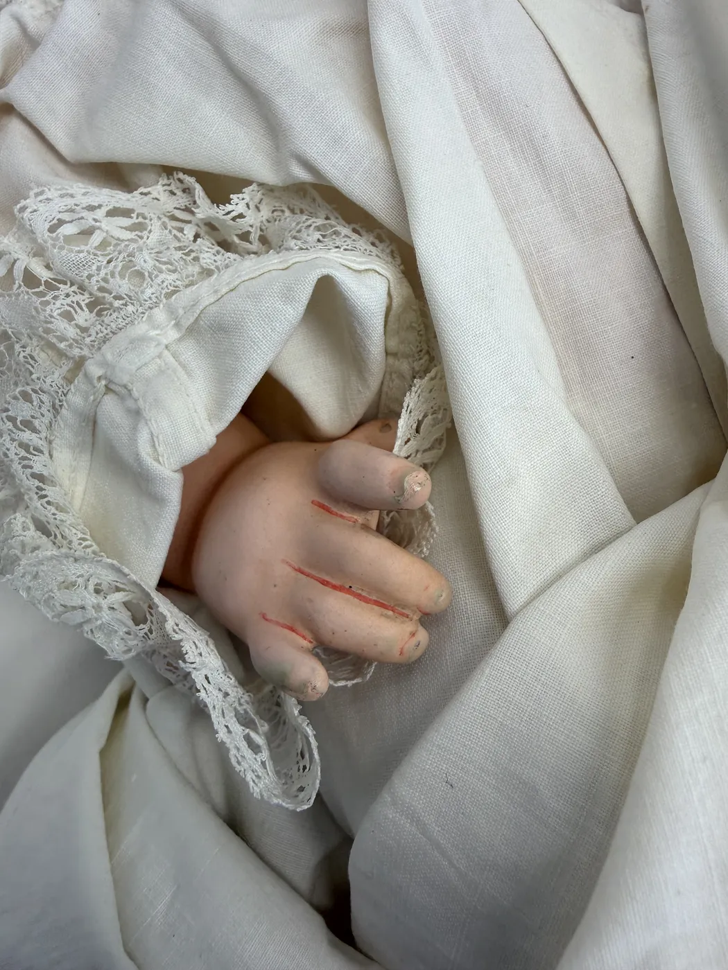 A view of the doll's lower torso, abdomen, and inner thigh, with the romper pulled aside. The composition surface is intact and pink-flesh-toned with the typical mild surface mottling of a hundred-year-old composition body. There is a small molded indication of an umbilicus. No cracks or chips are visible.